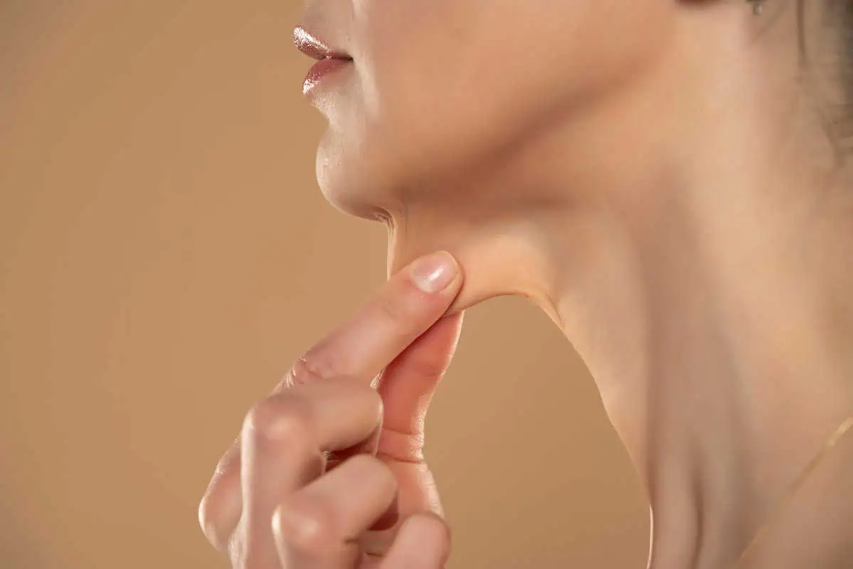 Kybella
