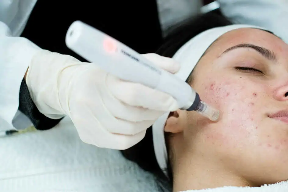 Woman receiving Hydrafacials Treatment