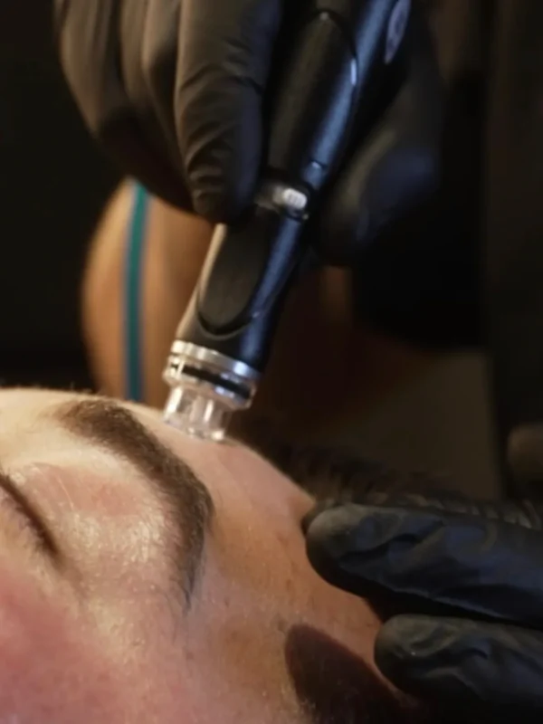 Hydrafacials in Escalon CA